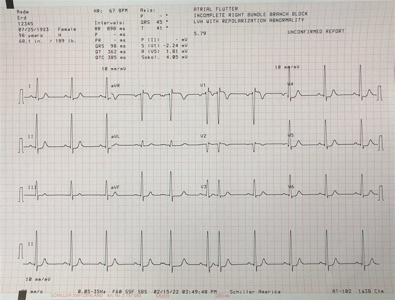Schiller Cardiovit AT-102 ECG (9.070000)