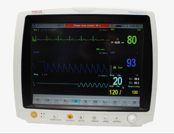 Schiller Tranquility II 12.1 inch Touchscreen Multiparameter Patient Monitor with ISA Side Stream Analyzer, CO2, O2, N2O, 5AA, AA ID, Built-In Printer - 0-750000ETP-401