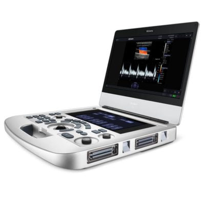 Edan Acclarix AX3 diagnostic ultrasound system