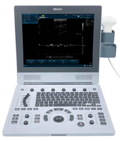 Ultrasound Systems
