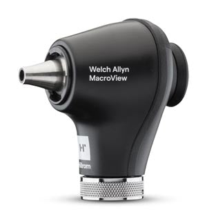 MacroView Basic Otoscope